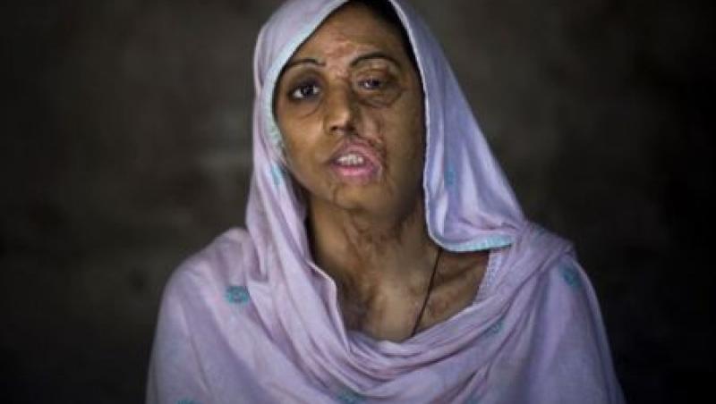 SOCANT! Afganistan: mutilata cu acid pentru ca nu vrut sa se marite