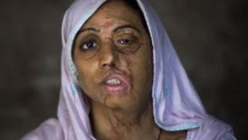 SOCANT! Afganistan: mutilata cu acid pentru ca nu vrut sa se marite