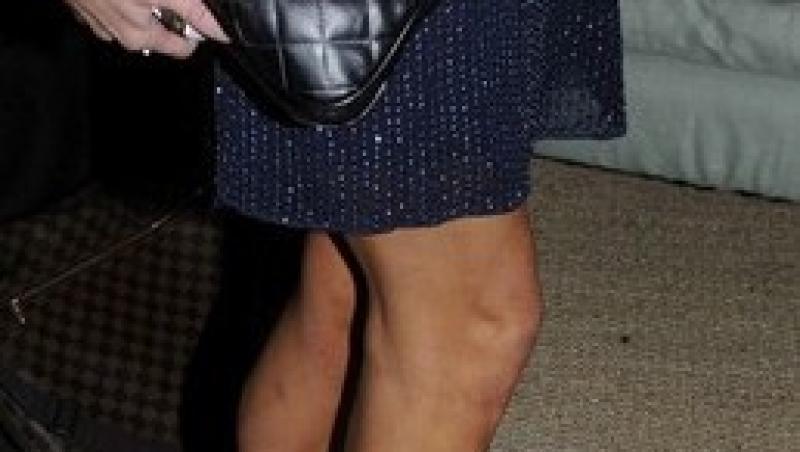 FOTO! Vezi ce picioare urate are Paris Hilton!