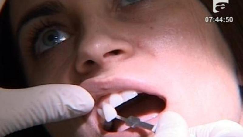 VIDEO! Dinti perfecti cu coroane dentare din zirconiu