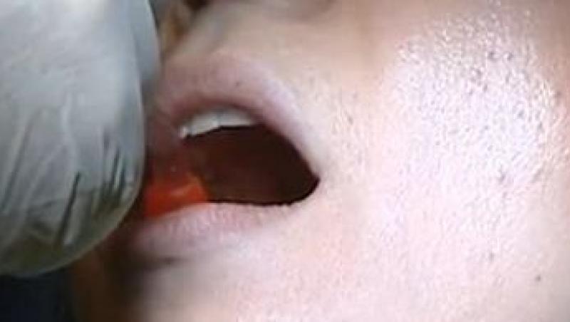 VIDEO! Cum sa scapati de respiratia urat mirositoare