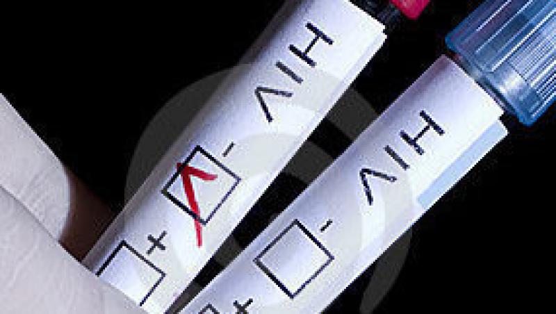 Vaccin anti-SIDA, realizat de medicii spanioli