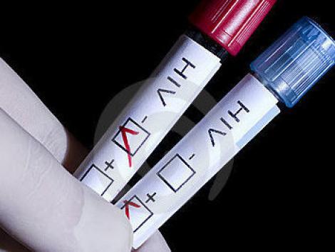 Vaccin anti-SIDA, realizat de medicii spanioli