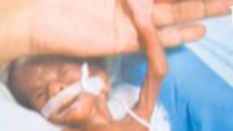 India: Supravietuire miraculoasa pentru un nou-nascut de 500 de grame