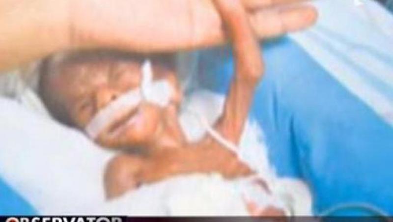 India: Supravietuire miraculoasa pentru un nou-nascut de 500 de grame