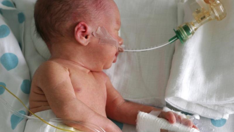 Ce trebuie sa stii despre copiii nascuti prematur