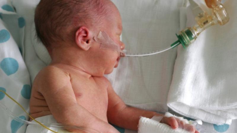 Ce trebuie sa stii despre copiii nascuti prematur