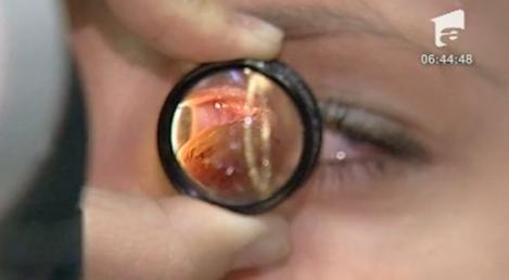 VIDEO! Ochii uscati - o boala cauzata de aerul conditionat