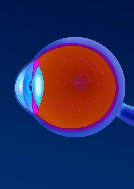 Prima retina artificiala ajunge in Europa