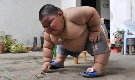 China: Un copil in varsta de 3 ani are o greutate de 57 de kg.