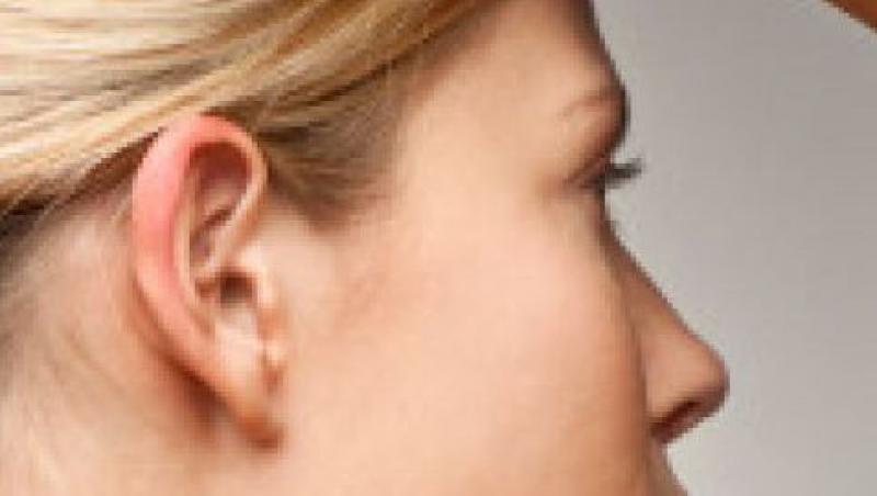 Otoplastia - urechile tale, in forma pe care o doresti