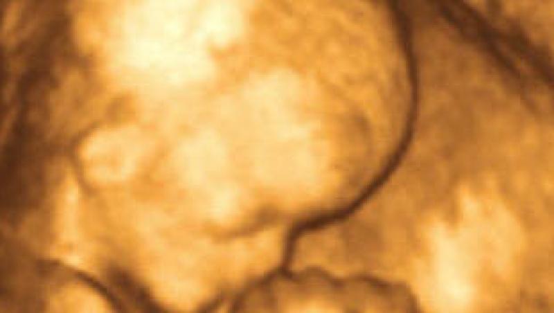 Ohio: Primul fetus chemat in instanta!