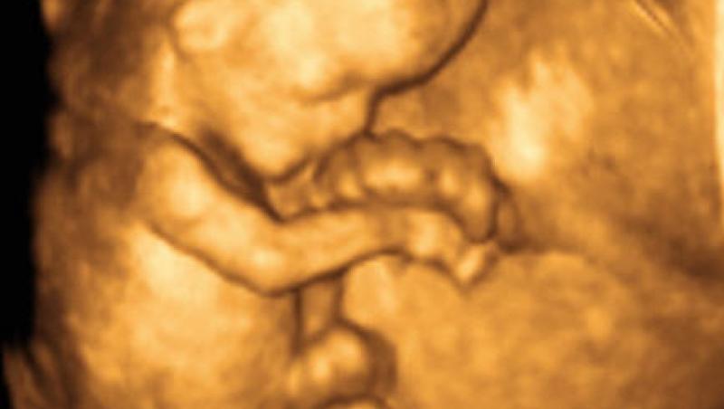 Ohio: Primul fetus chemat in instanta!