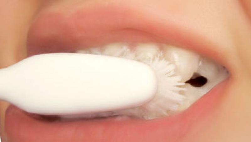Pasta de dinti nu previne formarea cariilor