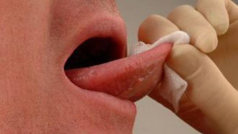VIDEO! Ce inseamna tratamentul prin taierea sub limba