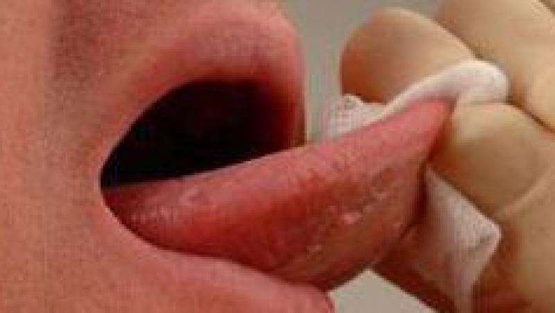 VIDEO! Ce inseamna tratamentul prin taierea sub limba