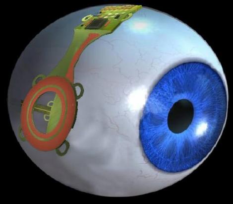 VIDEO! Ochiul bionic - o raza de lumina pentru nevazatori