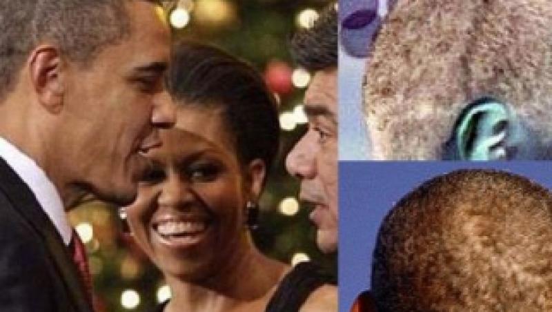 O cicatrice de pe scalpul lui Obama da nastere la teorii ale conspiratiei