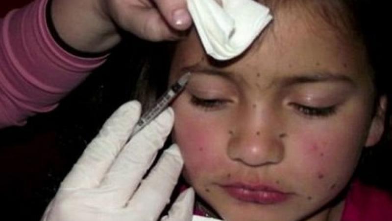 VIDEO! Copila injectata cu botox, luata din grija mamei