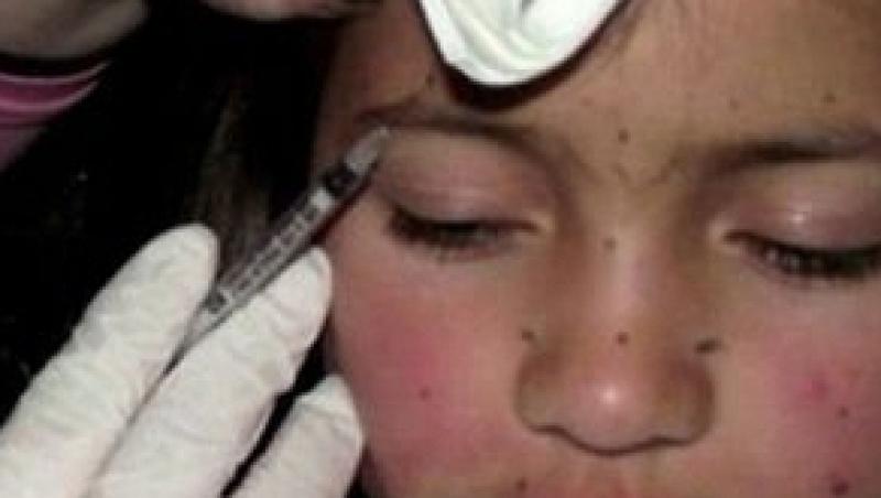 VIDEO! Copila injectata cu botox, luata din grija mamei