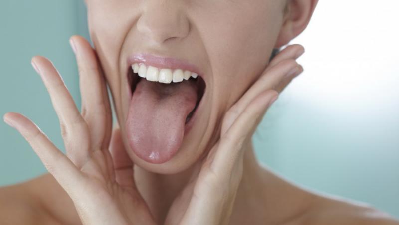 Afla cum poti vedea ce boli ai pe limba