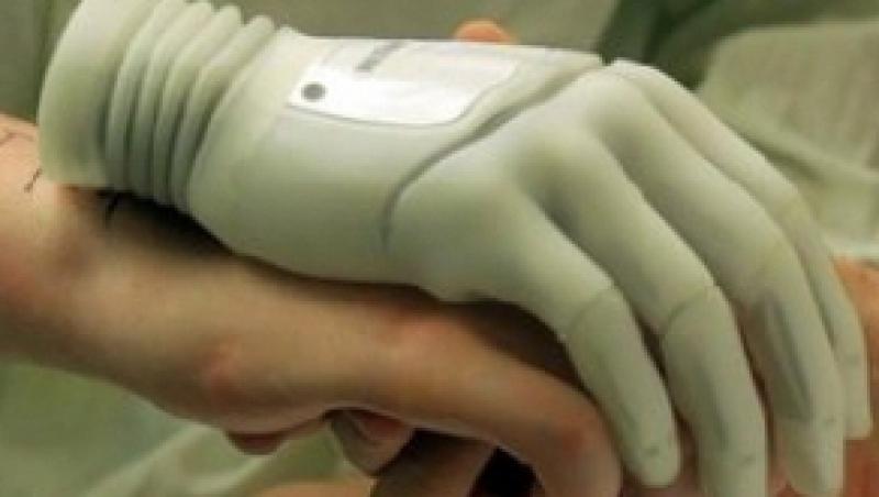 Mana bionica, proteza de ultima generatie testata de un australian