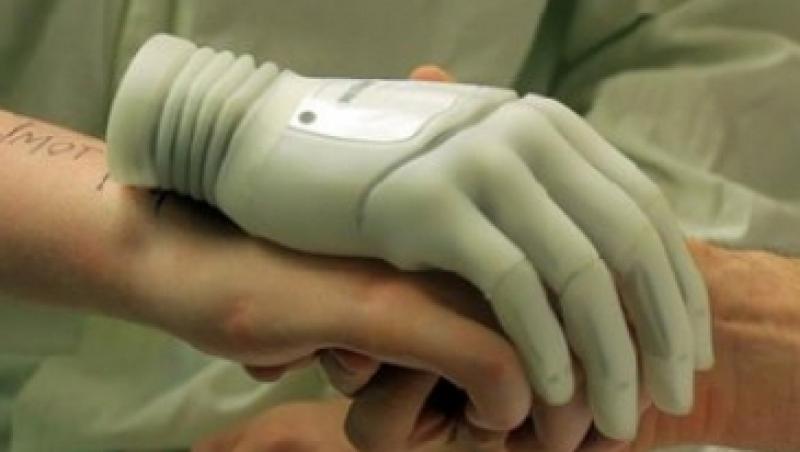 Mana bionica, proteza de ultima generatie testata de un australian