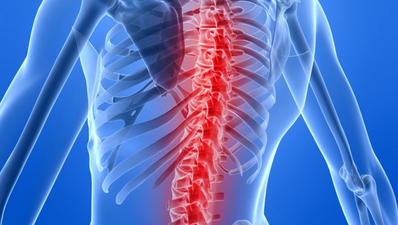 Ce trebuie sa stii despre coloana vertebrala
