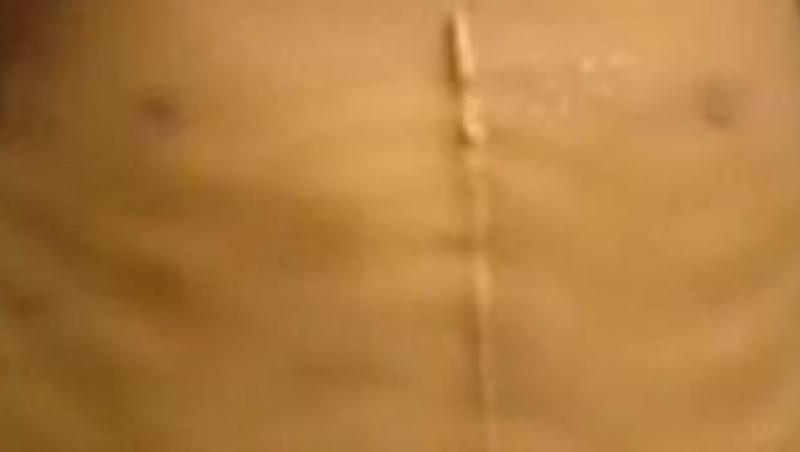 IMAGINI SOCANTE! Un copil din Bangladesh a fost mutilat pentru ca a refuzat sa cerseasca