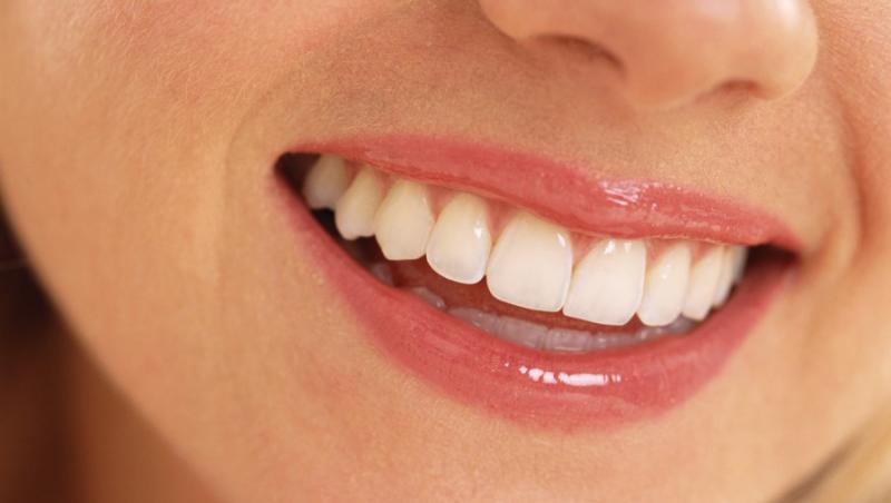 Gingivita netratata poate duce la pierderea dintilor!