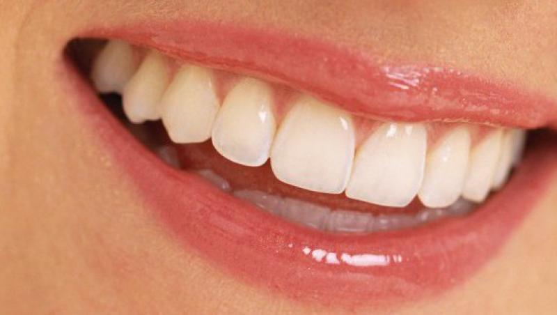 Gingivita netratata poate duce la pierderea dintilor!