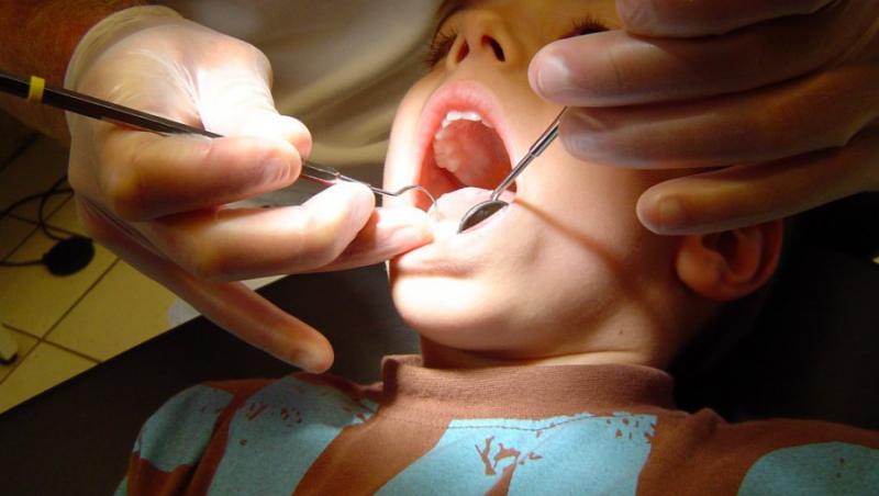 VIDEO! Afla totul despre sigilarea dentara la copii!