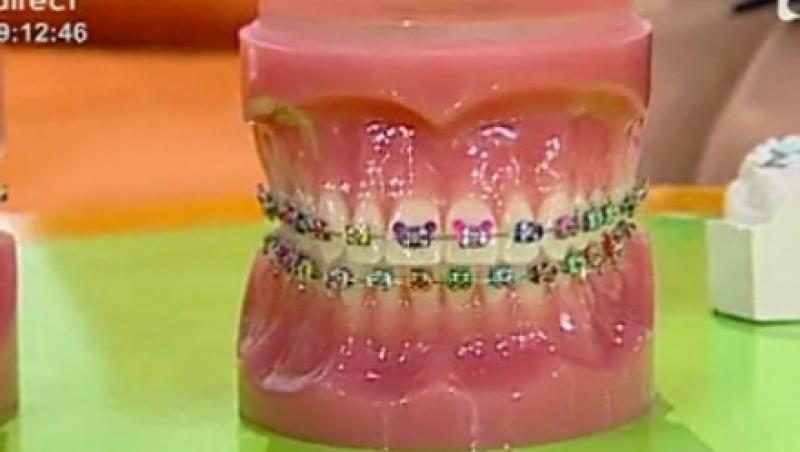 VIDEO! Prevenirea si tratamentul anomaliilor dento-maxilare la copii