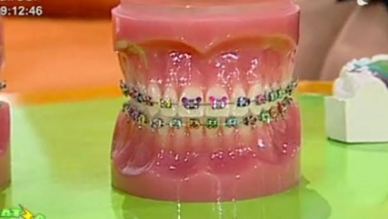 VIDEO! Prevenirea si tratamentul anomaliilor dento-maxilare la copii