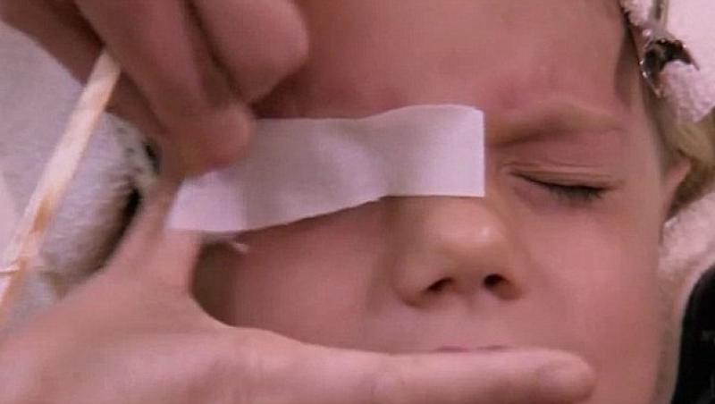 O fetita de noua ani, obisnuita cu agonia epilarii