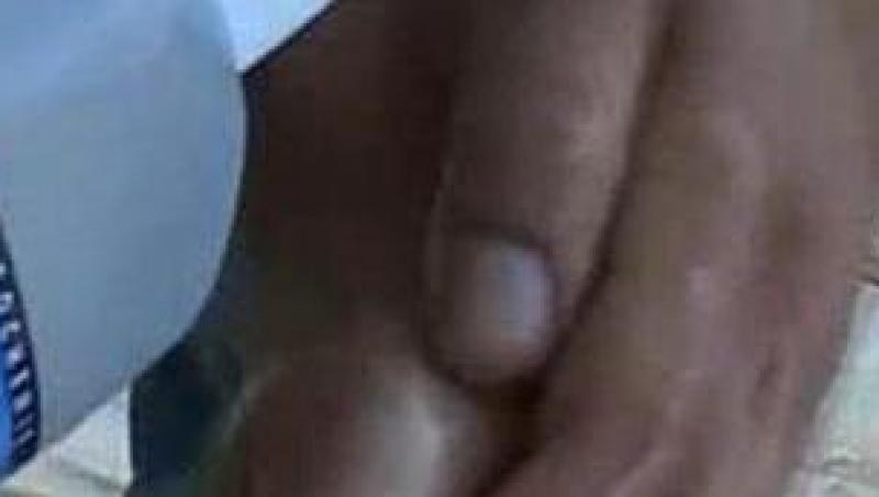 Vrancea: Angajat muscat de o fosta pacienta infectata cu HIV