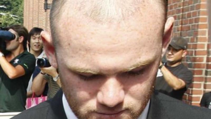 Transplantul de par al lui Wayne Rooney a dat gres