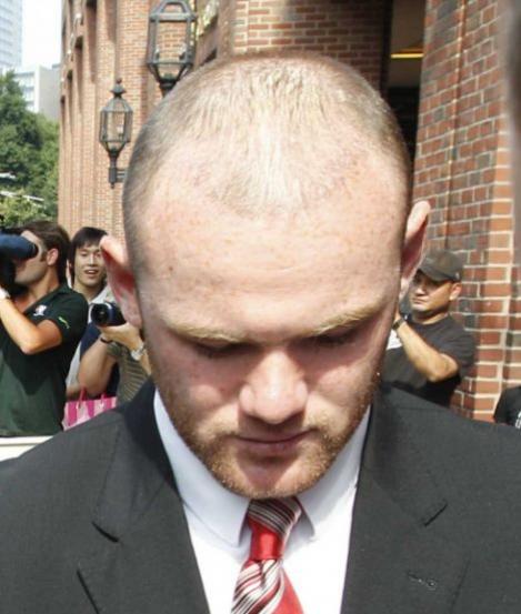 Transplantul de par al lui Wayne Rooney a dat gres