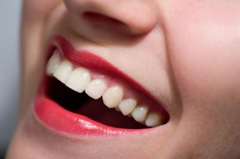 Slefuirea dintilor, metoda ideala pentru un zambet stralucitor