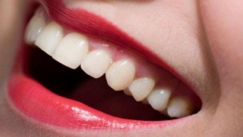 Slefuirea dintilor, metoda ideala pentru un zambet stralucitor