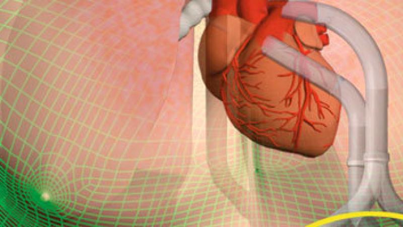 Plaman artificial, la fel de eficient ca cel uman