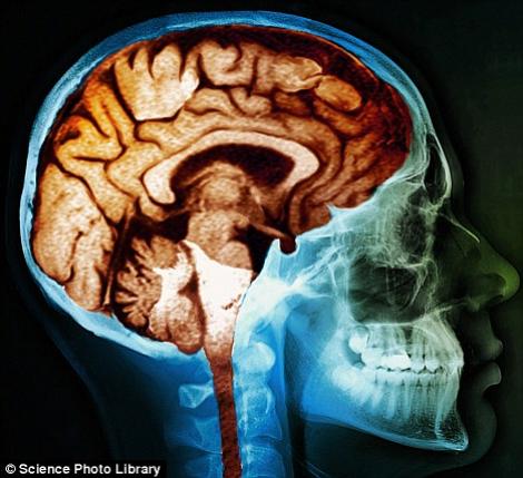 Creierul se micsoreaza ca urmare a pierderii materiei cenusii