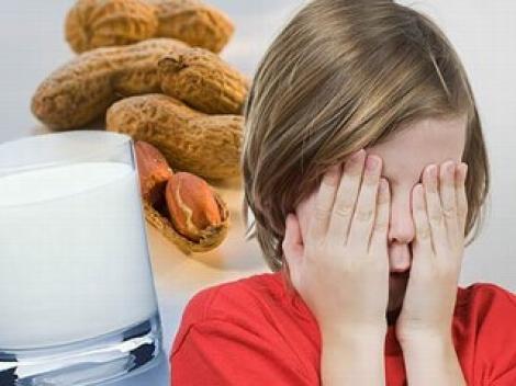 Copiii alergici la mancare se simt nesiguri la scoala