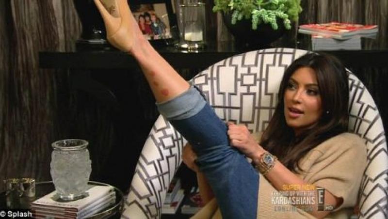 FOTO! Kim Kardashian, cu bube pe picioare!