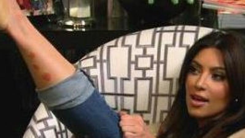 FOTO! Kim Kardashian, cu bube pe picioare!