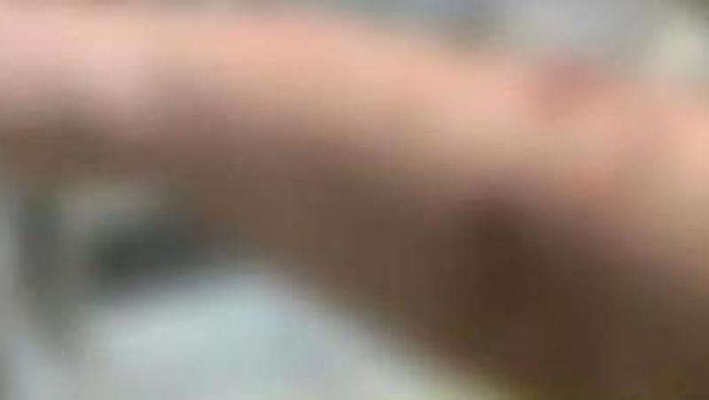 VIDEO! Iasi: O femeie a fost muscata de sotul si fiica ei, in urma unui scandal in familie