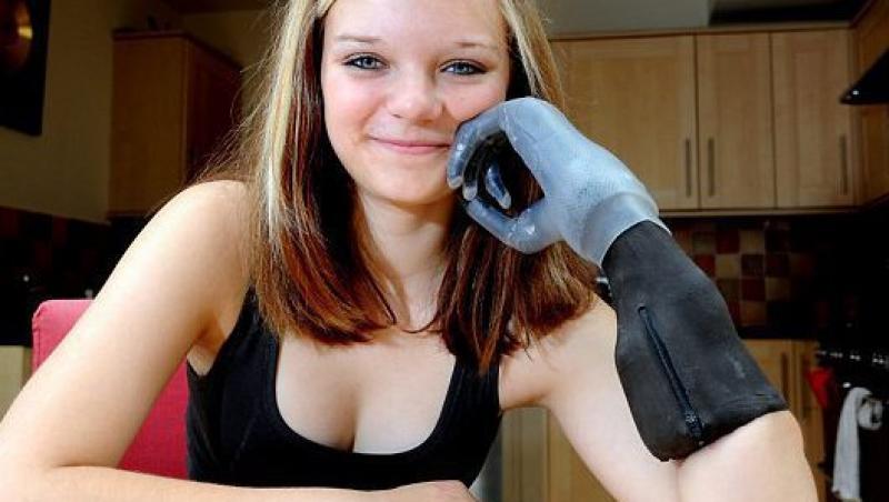 FOTO! Chloe Holmes, adolescenta cu degete bionice