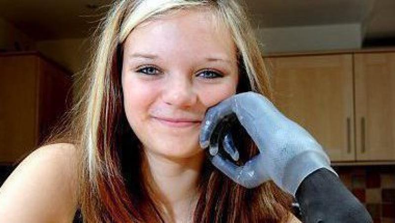 FOTO! Chloe Holmes, adolescenta cu degete bionice