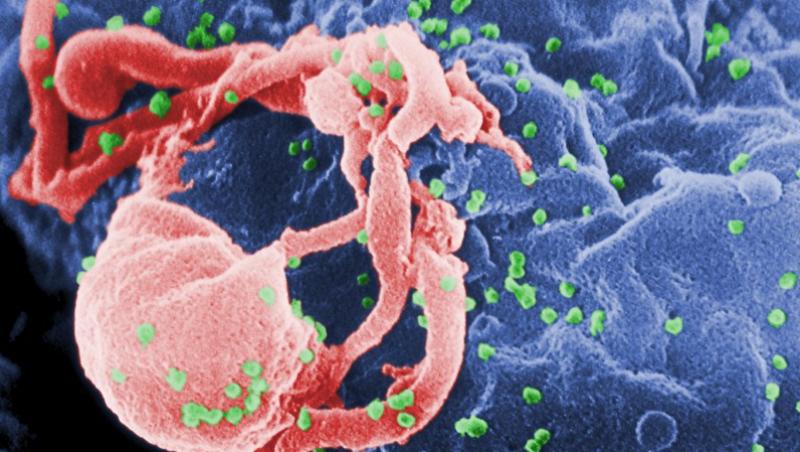 Vaccinul anti-HIV, tot mai aproape de realitate