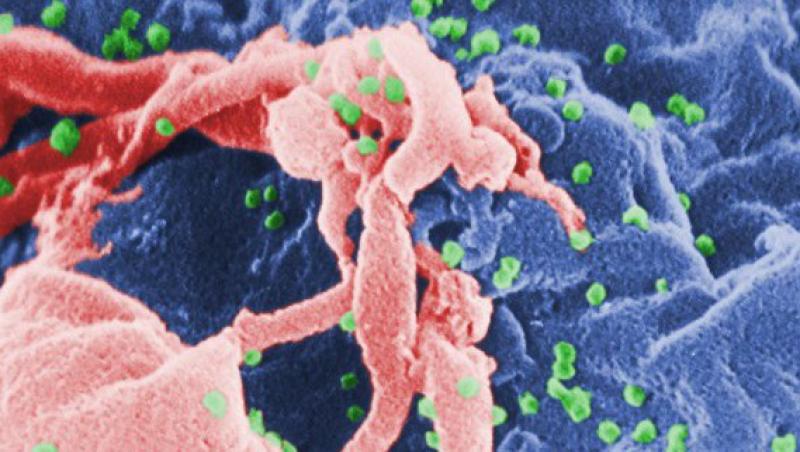 Vaccinul anti-HIV, tot mai aproape de realitate